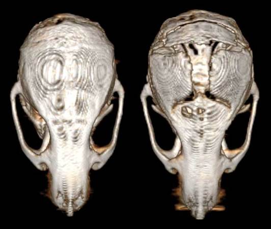 Brain cancer can dissolve parts of the skull
