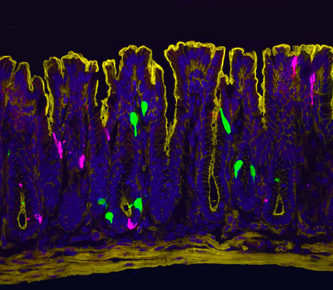 This newfound cascade of events may explain some female gut pain
