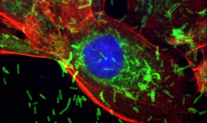 Gum disease bacteria can promote cancer growth in mice